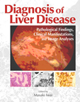Diagnosis of Liver Disease,